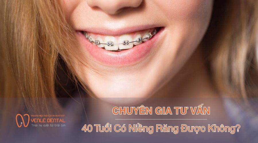 40 tuổi có niềng răng được không